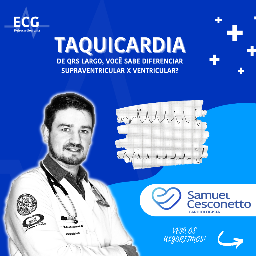 TV-x-Taqui-Supra.png